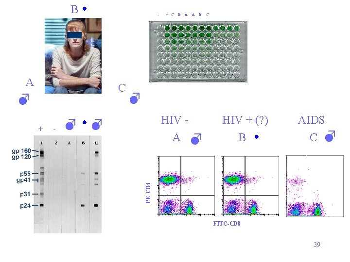 B - A C - B A A B C HIV A HIV +