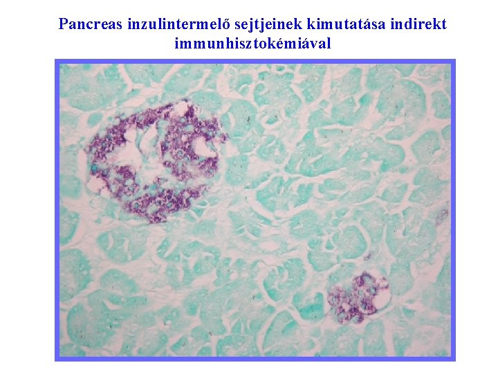 Pancreas inzulintermelő sejtjeinek kimutatása indirekt immunhisztokémiával Fluoreszcens immunhisztokémia Anti-nukleáris autoantitestek SLE-ben (FITC) 41 