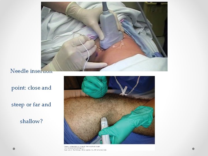 Needle insertion point: close and steep or far and shallow? 