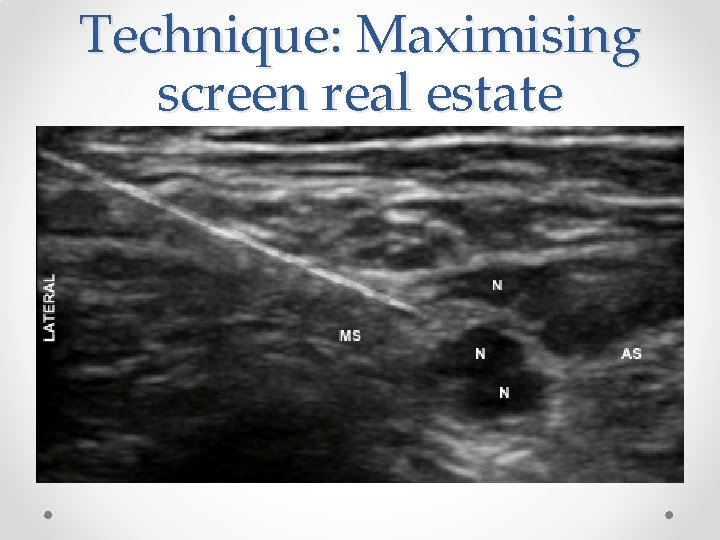 Technique: Maximising screen real estate 