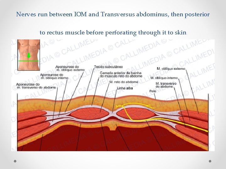 Nerves run between IOM and Transversus abdominus, then posterior to rectus muscle before perforating