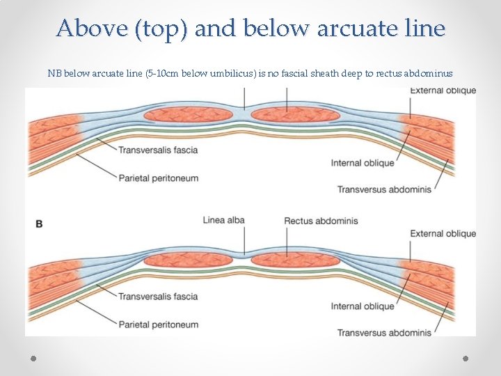 Above (top) and below arcuate line NB below arcuate line (5 -10 cm below