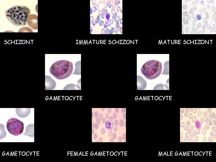 SCHIZONT IMMATURE SCHIZONT GAMETOCYTE FEMALE GAMETOCYTE MATURE SCHIZONT GAMETOCYTE MALE GAMETOCYTE 