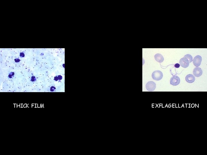 THICK FILM EXFLAGELLATION 