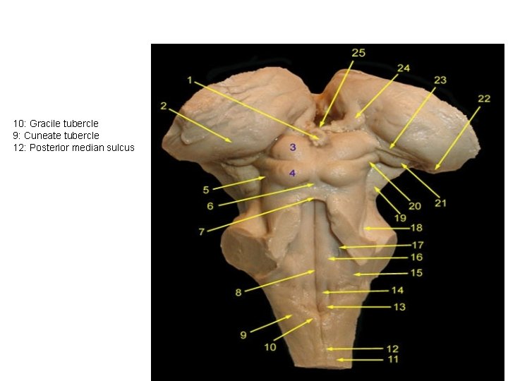 10: Gracile tubercle 9: Cuneate tubercle 12: Posterior median sulcus 