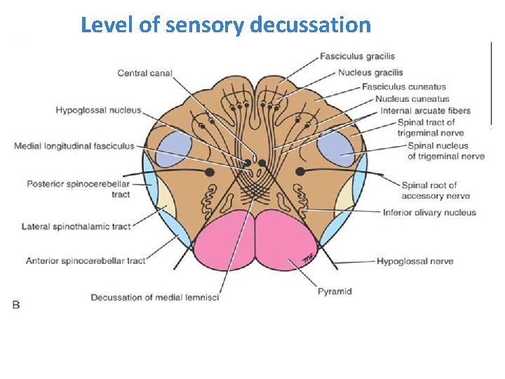 Level of sensory decussation 