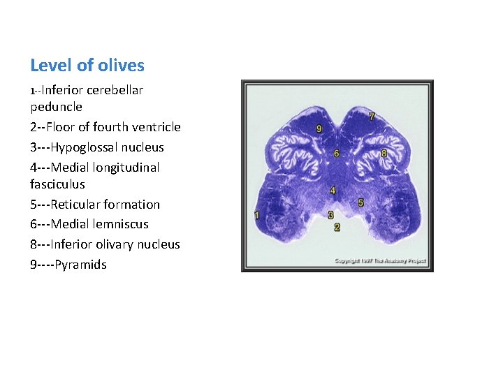 Level of olives 1 --Inferior cerebellar peduncle 2 --Floor of fourth ventricle 3 ---Hypoglossal
