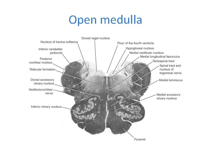 Open medulla 