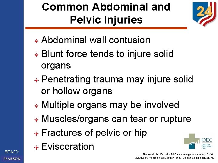 Common Abdominal and Pelvic Injuries l Abdominal BRADY wall contusion l Blunt force tends