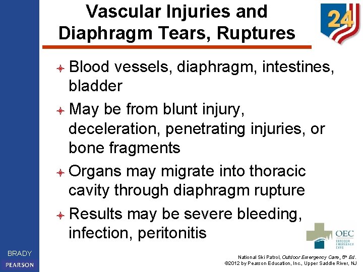 Vascular Injuries and Diaphragm Tears, Ruptures l Blood vessels, diaphragm, intestines, bladder l May