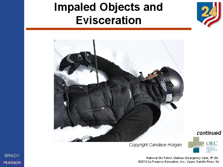 Impaled Objects and Evisceration continued Copyright Candace Horgan BRADY National Ski Patrol, Outdoor Emergency