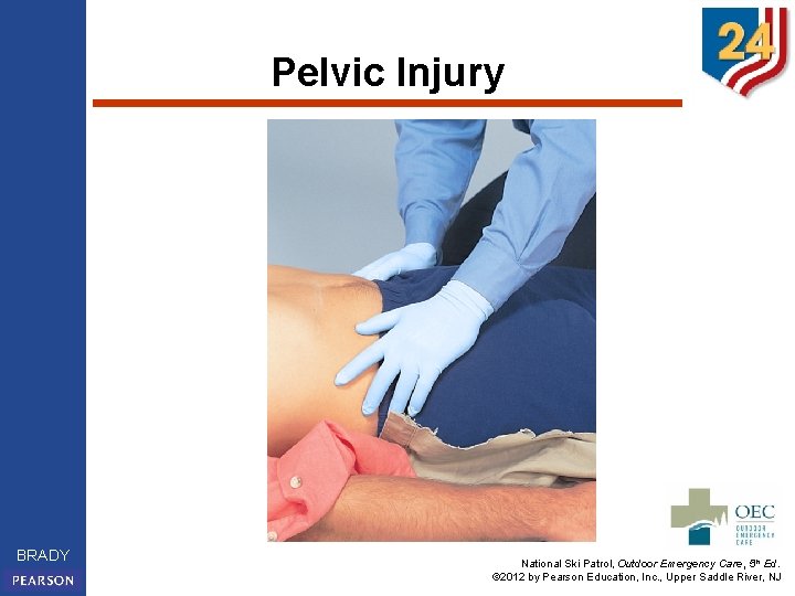 Pelvic Injury BRADY National Ski Patrol, Outdoor Emergency Care, 5 th Ed. © 2012