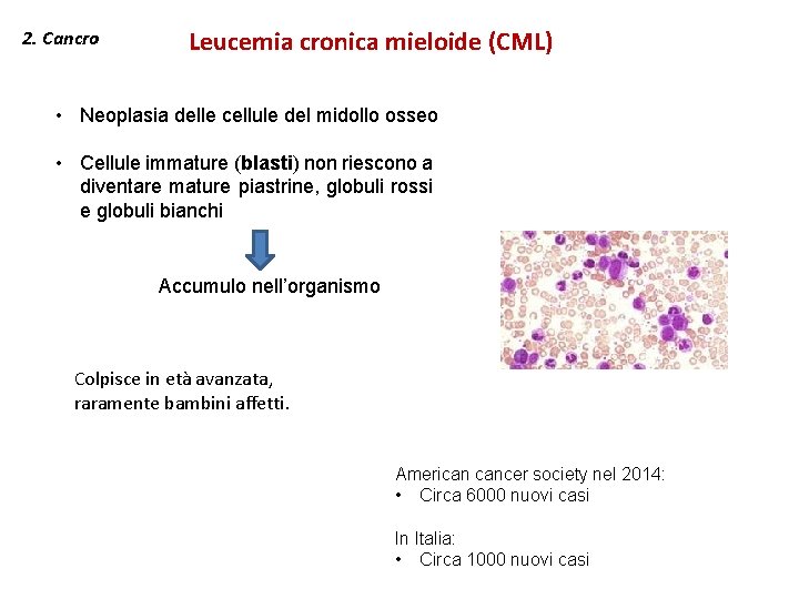 2. Cancro Leucemia cronica mieloide (CML) • Neoplasia delle cellule del midollo osseo •