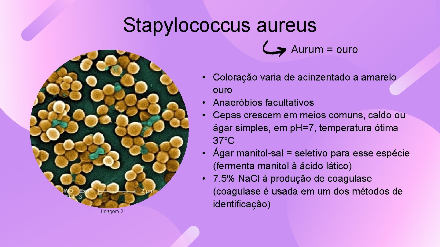 Stapylococcus aureus Aurum = ouro Imagem 2 • Coloração varia de acinzentado a amarelo