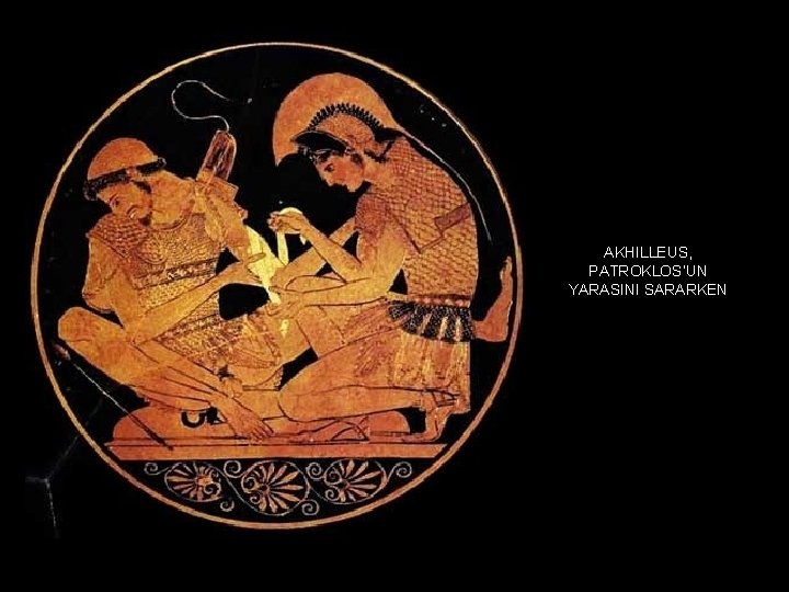 AKHILLEUS, PATROKLOS’UN YARASINI SARARKEN 