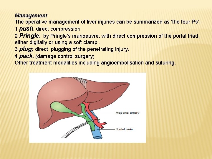 Management The operative management of liver injuries can be summarized as ‘the four Ps’: