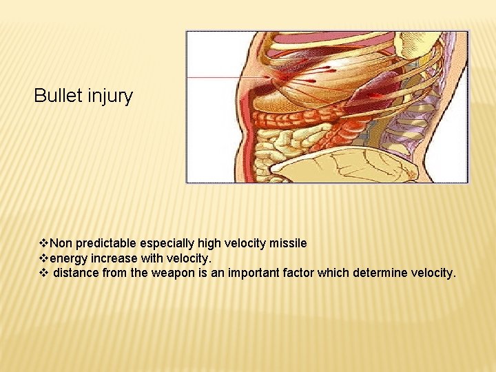 Bullet injury v. Non predictable especially high velocity missile venergy increase with velocity. v