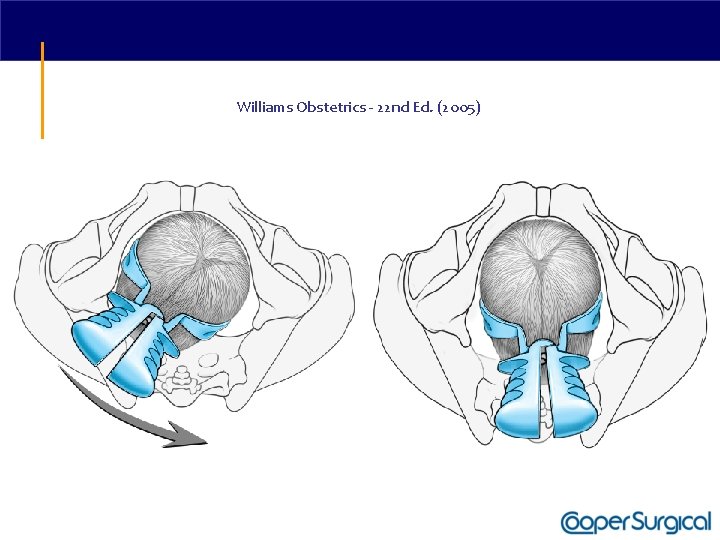 Williams Obstetrics - 22 nd Ed. (2005) 