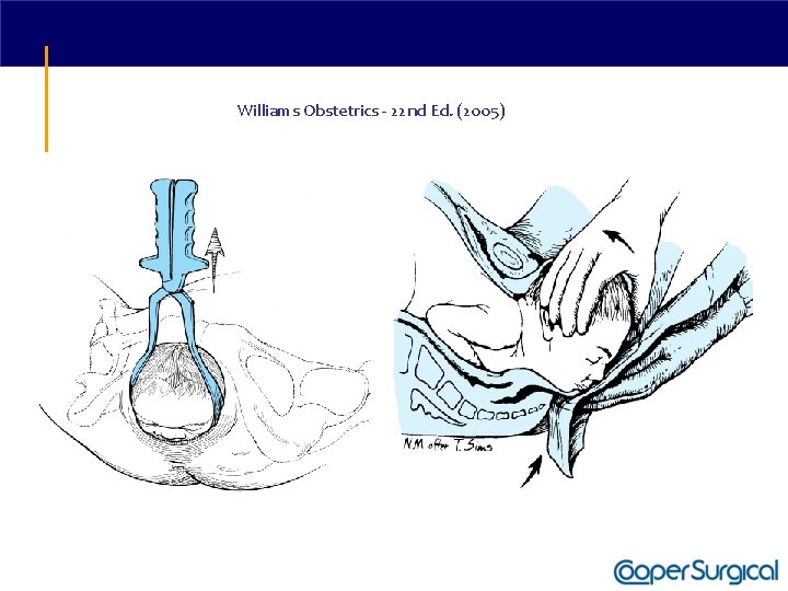 Williams Obstetrics - 22 nd Ed. (2005) 