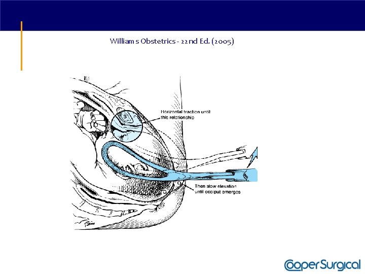 Williams Obstetrics - 22 nd Ed. (2005) 