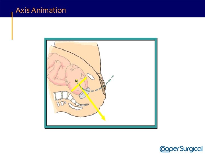 Axis Animation 