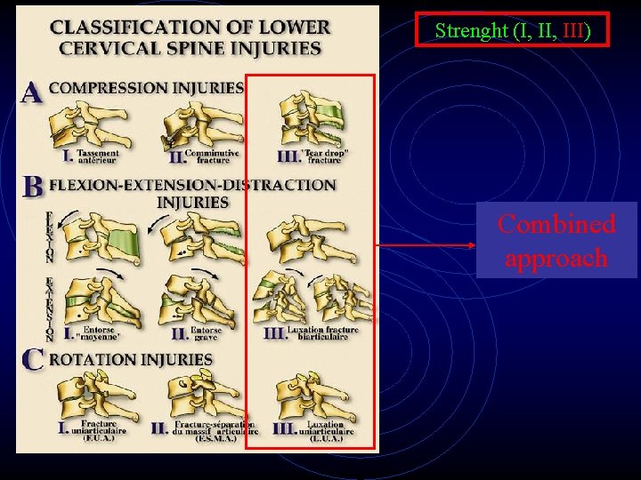 Strenght (I, III) Combined approach 