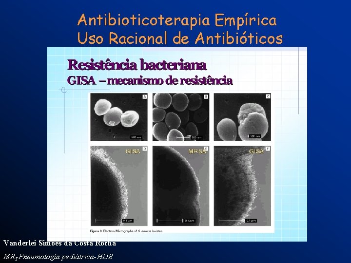 Antibioticoterapia Empírica Uso Racional de Antibióticos Vanderlei Simões da Costa Rocha MR 3 Pneumologia