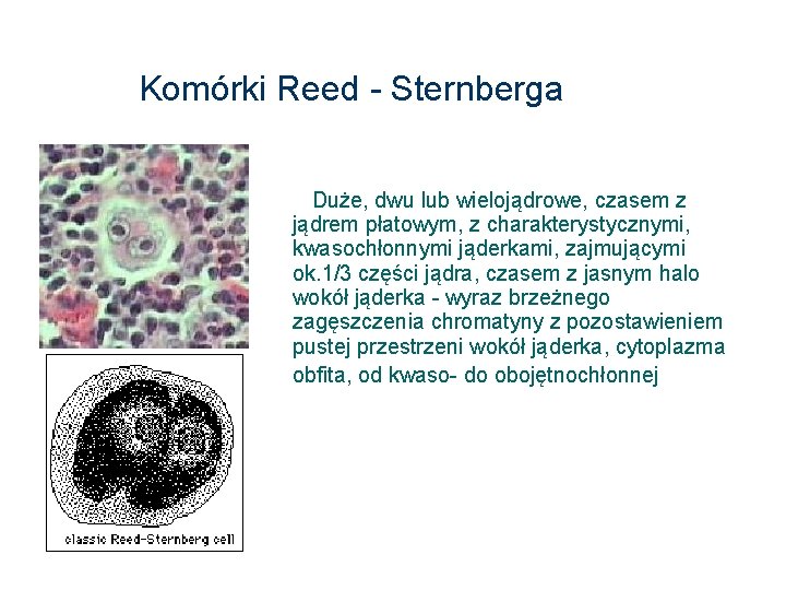 Komórki Reed - Sternberga Duże, dwu lub wielojądrowe, czasem z jądrem płatowym, z charakterystycznymi,