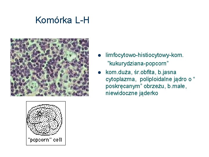 Komórka L-H limfocytowo-histiocytowy-kom. ”kukurydziana-popcorn” kom. duża, śr. obfita, b. jasna cytoplazma, poliploidalne jądro o