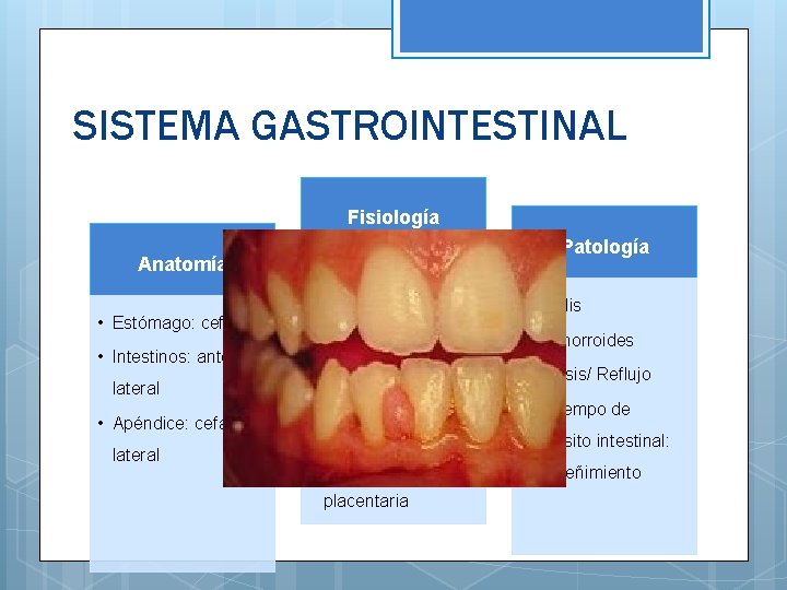 SISTEMA GASTROINTESTINAL Fisiología Anatomía • Estómago: cefálico • Intestinos: anteriorlateral • Apéndice: cefálicolateral Patología