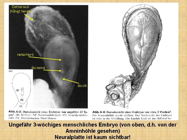 Dottersack (hängt herab) notochord őscsomó őscsík Ungefähr 3 -wöchiges menschliches Embryo (von oben, d.