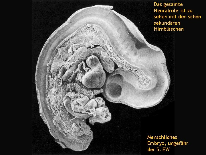Das gesamte Neuralrohr ist zu sehen mit den schon sekundären Hirnbläschen Menschliches Embryo, ungefähr