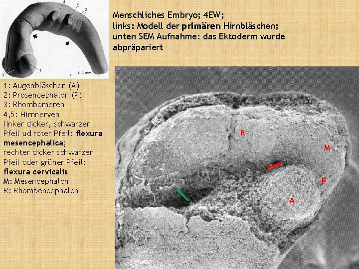 Menschliches Embryo; 4 EW; links: Modell der primären Hirnbläschen; unten SEM Aufnahme: das Ektoderm