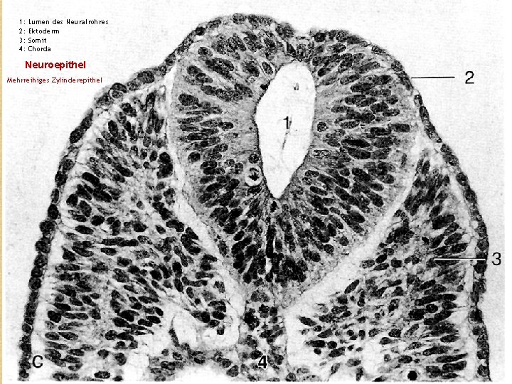 1: 2: 3: 4: Lumen des Neuralrohres Ektoderm Somit Chorda Neuroepithel Mehrreihiges Zylinderepithel 