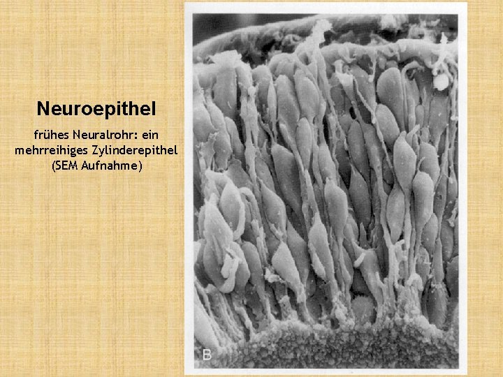 Neuroepithel frühes Neuralrohr: ein mehrreihiges Zylinderepithel (SEM Aufnahme) 