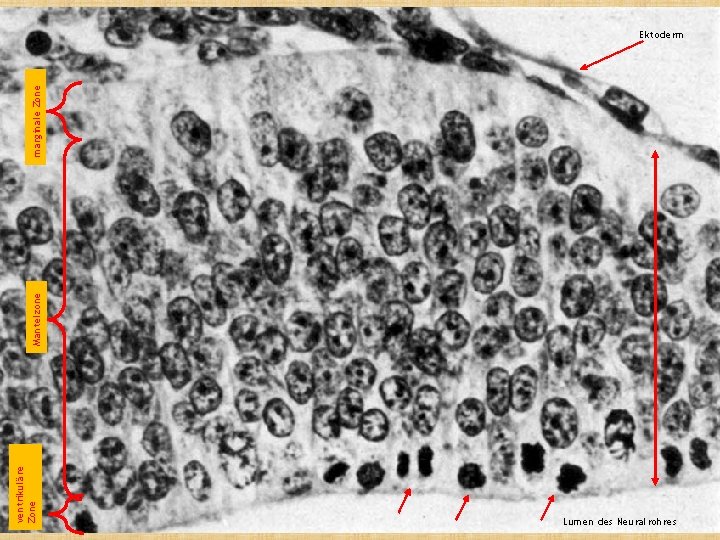 ventrikuläre Zone Mantelzone marginale Zone Ektoderm Lumen des Neuralrohres 