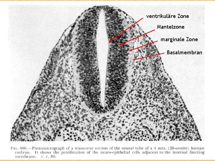 ventrikuläre Zone Mantelzone marginale Zone Basalmembran 