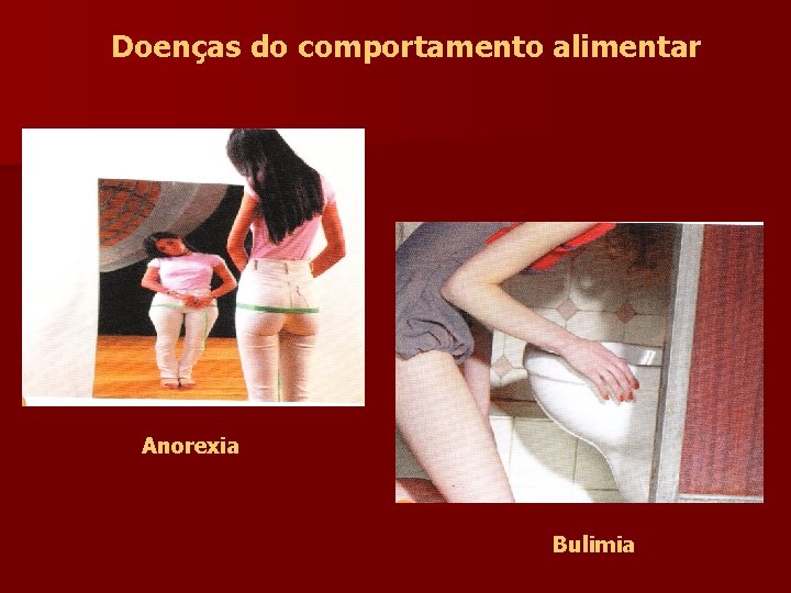 Doenças do comportamento alimentar Anorexia Bulimia 