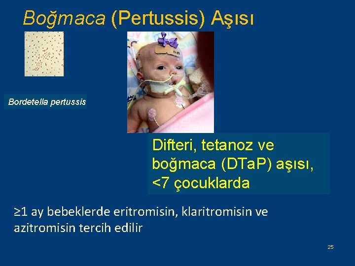 Boğmaca (Pertussis) Aşısı Bordetella pertussis Difteri, tetanoz ve boğmaca (DTa. P) aşısı, <7 çocuklarda