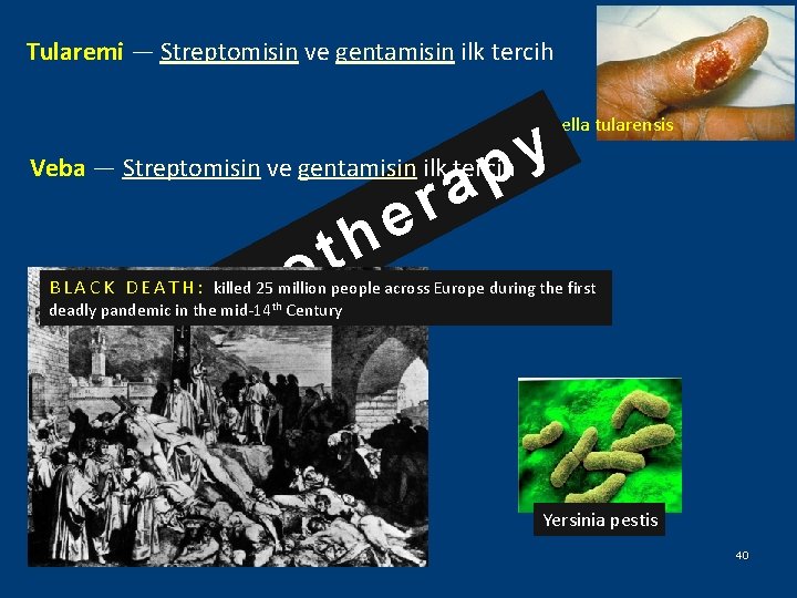 Tularemi — Streptomisin ve gentamisin ilk tercih Francisella tularensis y p Veba — Streptomisin