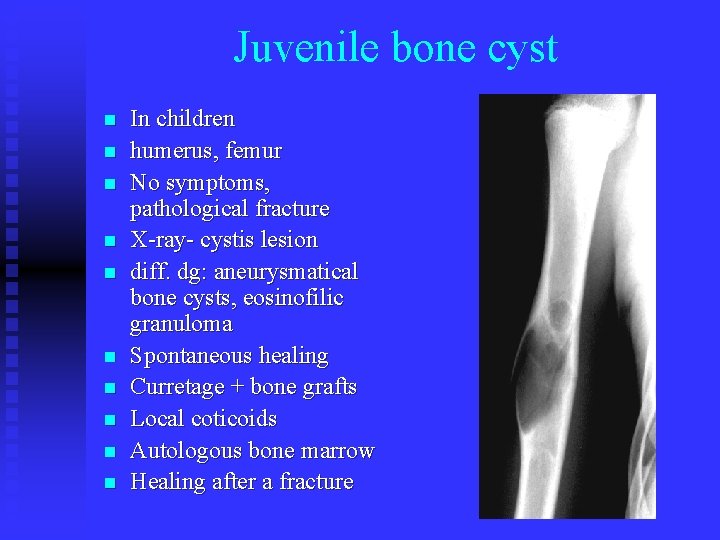 Juvenile bone cyst n n n n n In children humerus, femur No symptoms,