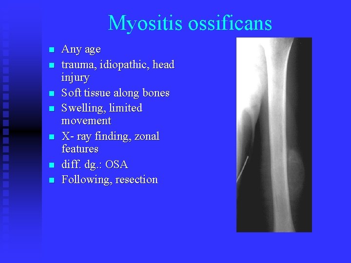 Myositis ossificans n n n n Any age trauma, idiopathic, head injury Soft tissue