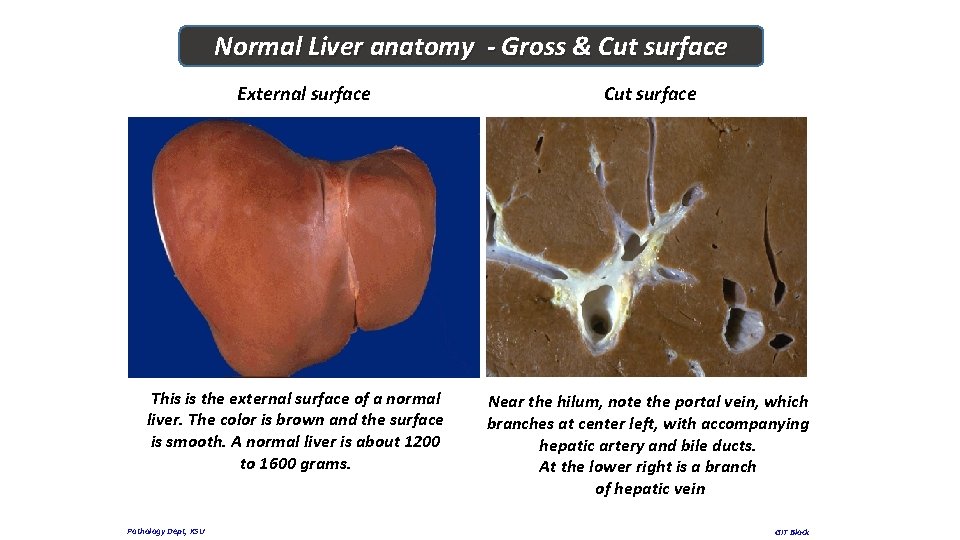 Normal Liver anatomy - Gross & Cut surface External surface This is the external