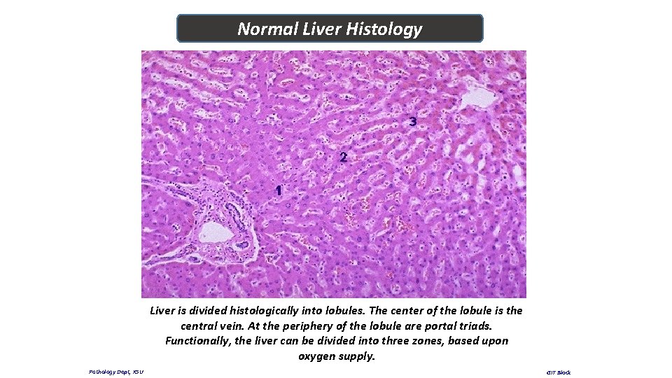 Normal Liver Histology Liver is divided histologically into lobules. The center of the lobule