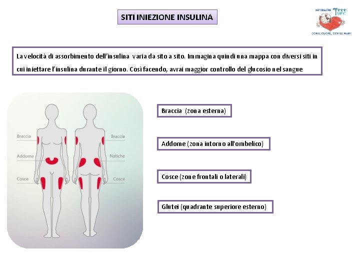 SITI INIEZIONE INSULINA La velocità di assorbimento dell’insulina varia da sito. Immagina quindi una