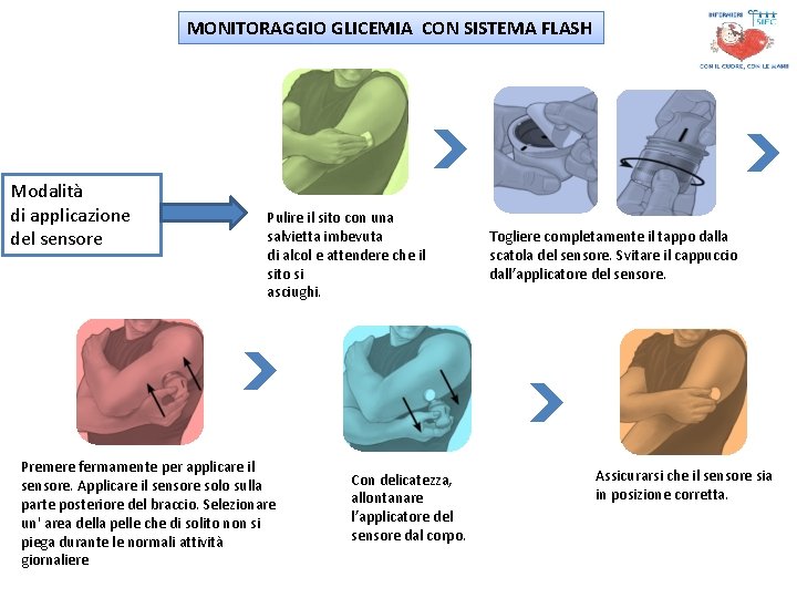 MONITORAGGIO GLICEMIA CON SISTEMA FLASH Modalità di applicazione del sensore Pulire il sito con