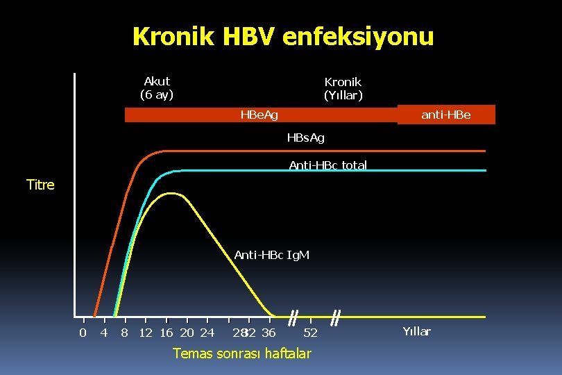 Kronik HBV enfeksiyonu Akut (6 ay) Kronik (Yıllar) HBe. Ag anti-HBe HBs. Ag Anti-HBc