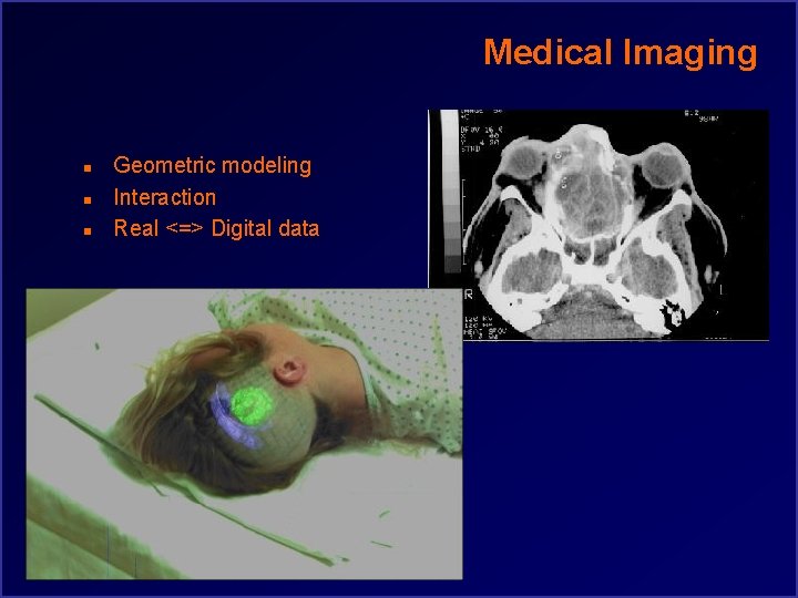 Medical Imaging n n n Geometric modeling Interaction Real <=> Digital data 