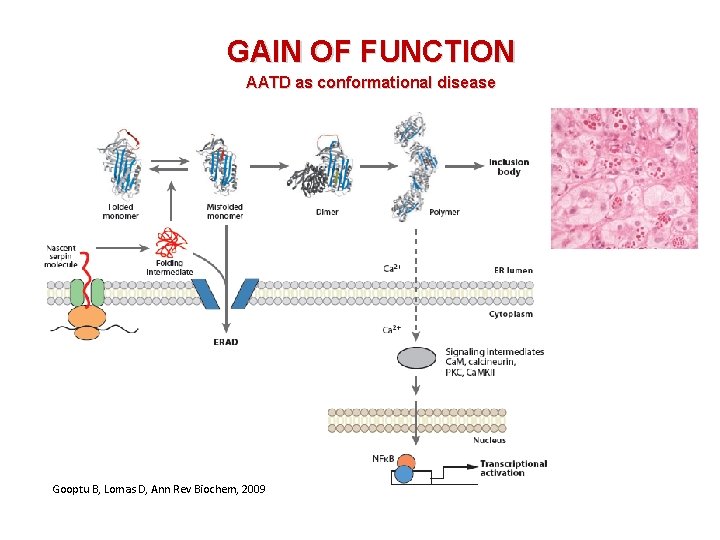 GAIN OF FUNCTION AATD as conformational disease Gooptu B, Lomas D, Ann Rev Biochem,