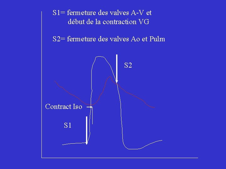 S 1= fermeture des valves A-V et début de la contraction VG S 2=